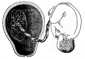 Fig.200. Mature human foetus (at the end of the pregnancy, in its natural position, taken out of the uterine cavity).