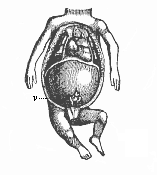 Fig.357. Thoracic and abdominal viscera of a human embryo of twelve weeks.